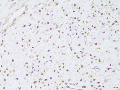 Immunohistochemistry of paraffin-embedded Human leiomyoma of uterus using FKBP4 Polyclonal Antibody at dilution of  1:100 (40x lens).