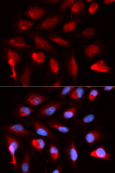 Immunofluorescence analysis of U2OS cells using PPARD Polyclonal Antibody