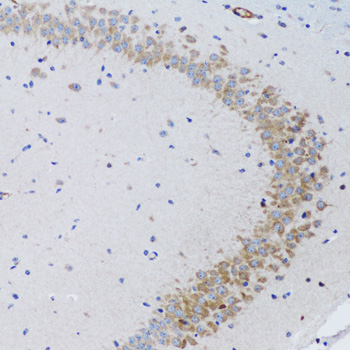 Immunohistochemistry of paraffin-embedded Rat brain using TNFSF12 Polyclonal Antibody at dilution of  1:100 (20x lens).