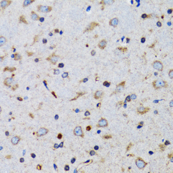 Immunohistochemistry of paraffin-embedded Mouse brain using TNFSF12 Polyclonal Antibody at dilution of  1:100 (40x lens).