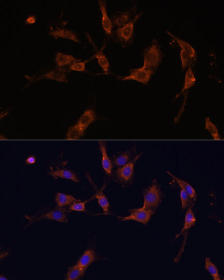 Immunofluorescence analysis of C6 cells using IQGAP1 Polyclonal Antibody at dilution of  1:100 (40x lens). Blue: DAPI for nuclear staining.