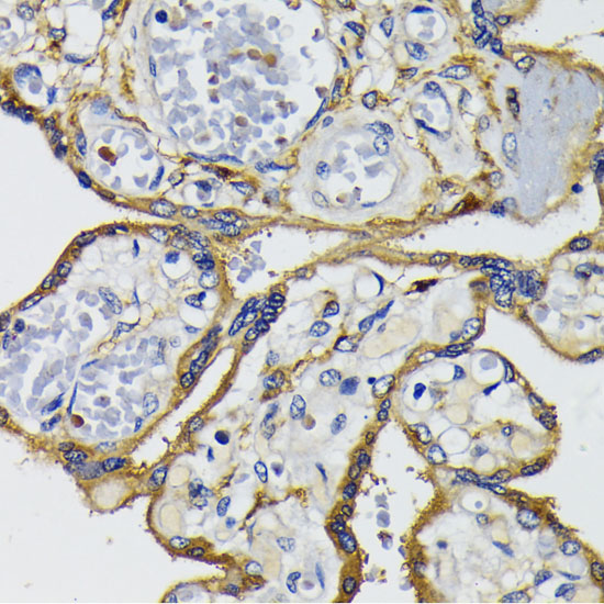 Immunohistochemistry of paraffin-embedded Human placenta using IQGAP1 Polyclonal Antibody at dilution of  1:200 (40x lens).