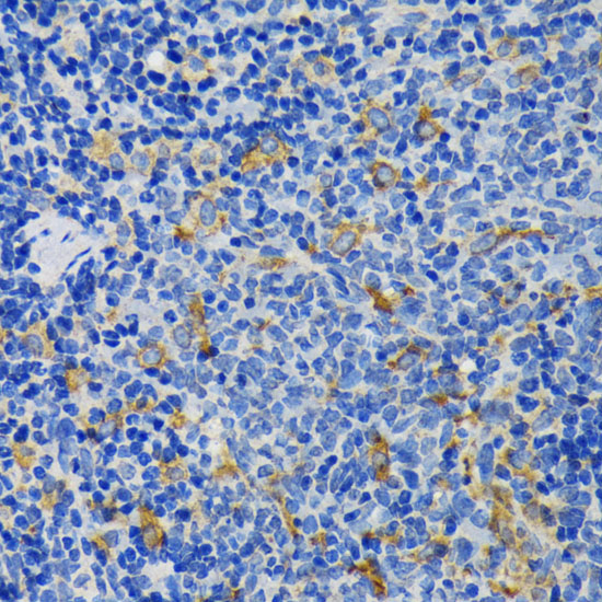 Immunohistochemistry of paraffin-embedded Rat spleen using IQGAP1 Polyclonal Antibody at dilution of  1:200 (40x lens).