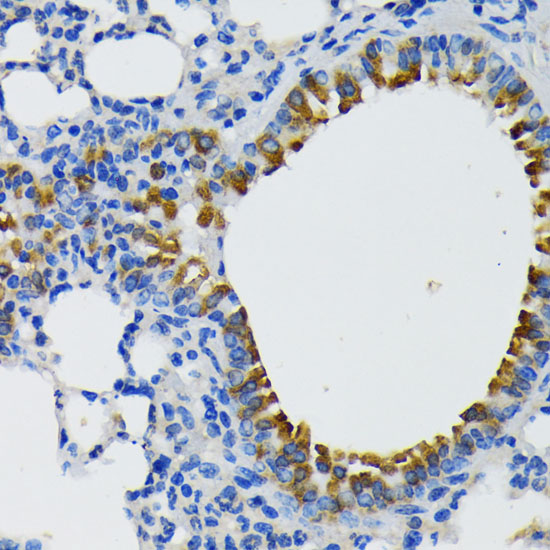 Immunohistochemistry of paraffin-embedded Mouse lung using IQGAP1 Polyclonal Antibody at dilution of  1:200 (40x lens).