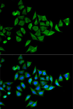 Immunofluorescence analysis of HeLa cells using DOK1 Polyclonal Antibody