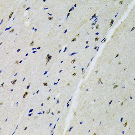 Immunohistochemistry of paraffin-embedded Mouse heart using DOK1 Polyclonal Antibody at dilution of  1:100 (40x lens).