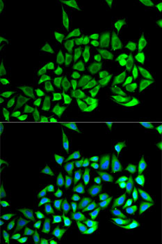 Immunofluorescence analysis of U2OS cells using GSTP1 Polyclonal Antibody