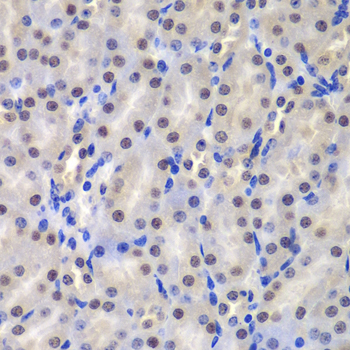 Immunohistochemistry of paraffin-embedded Mouse kidney using GSTP1 Polyclonal Antibody at dilution of  1:200 (40x lens).