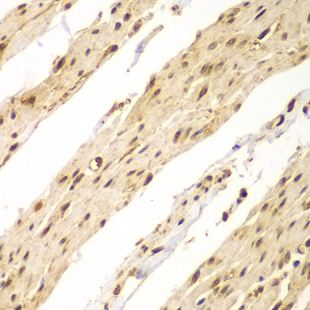 Immunohistochemistry of paraffin-embedded Human colon using CDX1 Polyclonal Antibody at dilution of  1:100 (40x lens).