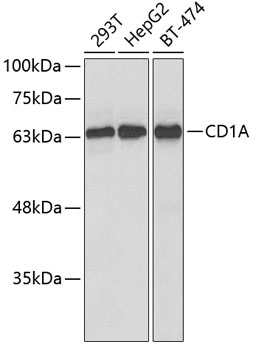 Western blot analysis of extracts of various cell lines using CD1A Polyclonal Antibody at dilution of 1:1000.