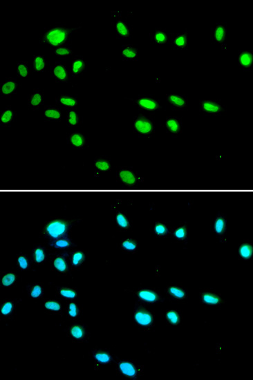 Immunofluorescence analysis of A549 cells using RUVBL1 Polyclonal Antibody