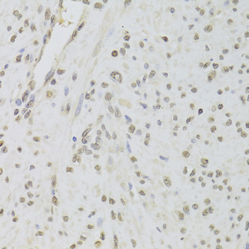 Immunohistochemistry of paraffin-embedded Human leiomyoma of uterus using RUVBL1 Polyclonal Antibody at dilution of  1:100 (40x lens).