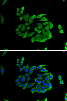 Immunofluorescence analysis of U2OS cells using Heparanase 1 Polyclonal Antibody