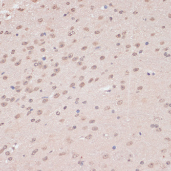 Immunohistochemistry of paraffin-embedded Mouse brain using PRPF31 Polyclonal Antibody at dilution of  1:100 (40x lens).