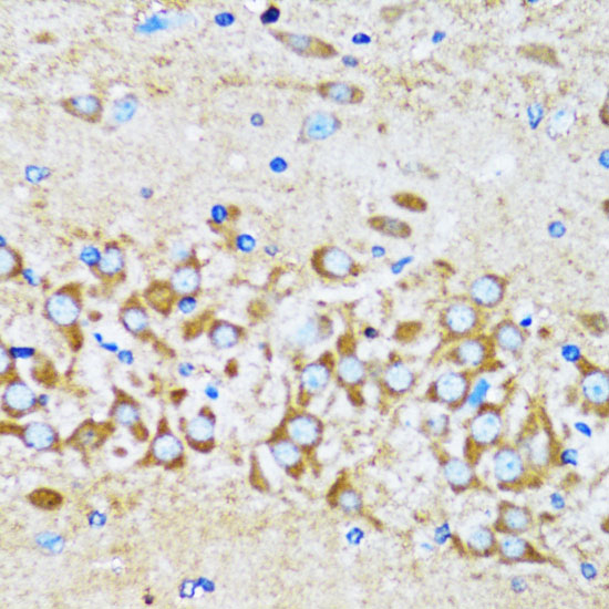 Immunohistochemistry of paraffin-embedded Mouse brain using ACTR2 Polyclonal Antibody at dilution of  1:100 (40x lens).