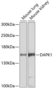 Western blot analysis of extracts of various cell lines using DAPK1 Polyclonal Antibody at dilution of 1:1000.