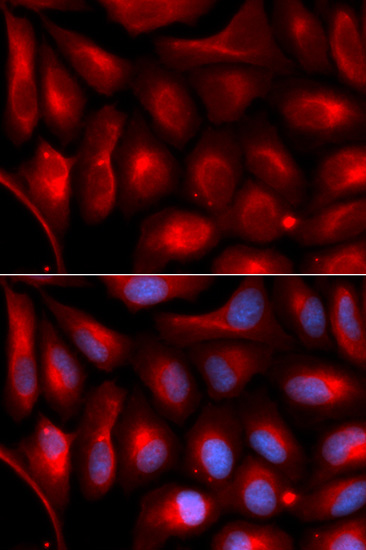 Immunofluorescence analysis of U2OS cells using PSMA5 Polyclonal Antibody