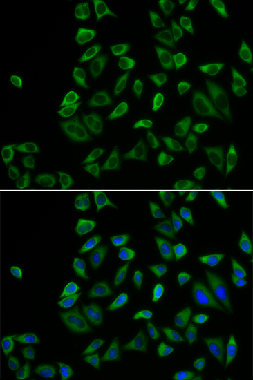 Immunofluorescence analysis of HeLa cells using PEX5 Polyclonal Antibody