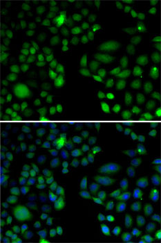 Immunofluorescence analysis of U2OS cells using EPC1 Polyclonal Antibody