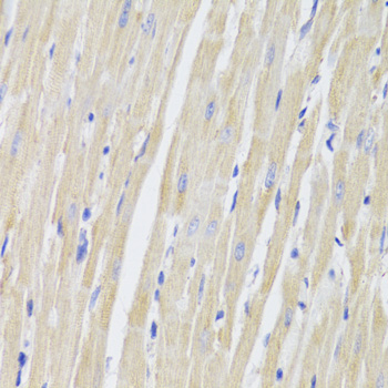 Immunohistochemistry of paraffin-embedded Rat heart using TTC11 / FIS1 Polyclonal Antibody at dilution of  1:100 (40x lens).