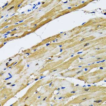 Immunohistochemistry of paraffin-embedded Rat heart using GOT1 Polyclonal Antibody at dilution of  1:100 (40x lens).