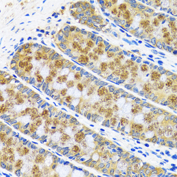 Immunohistochemistry of paraffin-embedded Human colon using GOT1 Polyclonal Antibody at dilution of  1:100 (40x lens).