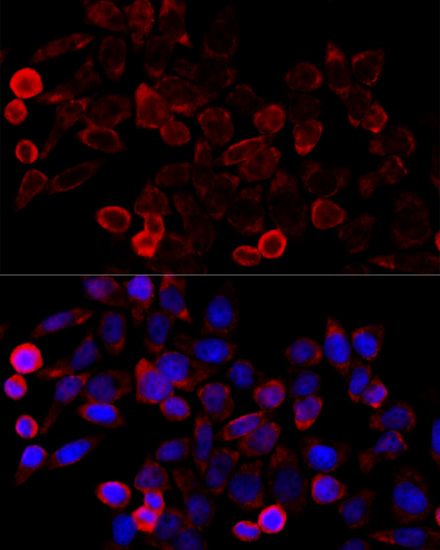 Immunofluorescence analysis of HeLa cells using KAT7 Polyclonal Antibody at dilution of  1:100 (40x lens). Blue: DAPI for nuclear staining.