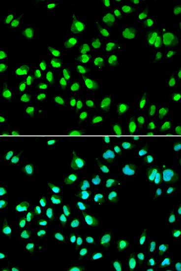 Immunofluorescence analysis of A549 cells using GTF2F2 Polyclonal Antibody