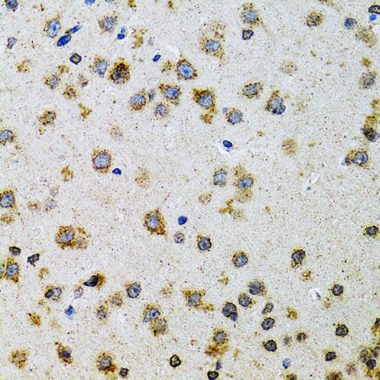 Immunohistochemistry of paraffin-embedded Rat brain using PDYN Polyclonal Antibody at dilution of  1:100 (40x lens).