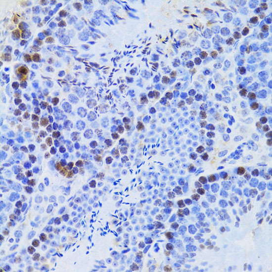 Immunohistochemistry of paraffin-embedded Mouse testis using JMJD6 Polyclonal Antibody at dilution of  1:100 (40x lens).