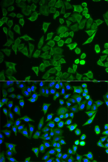 Immunofluorescence analysis of HeLa cells using NPRL2 Polyclonal Antibody