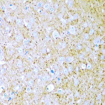 Immunohistochemistry of paraffin-embedded Rat brain using WNT2 Polyclonal Antibody at dilution of  1:200 (40x lens).