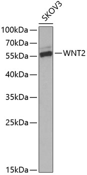 Western blot analysis of extracts of SKOV3 cells using WNT2 Polyclonal Antibody at dilution of 1:1000.