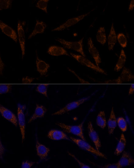 Immunofluorescence analysis of L929 cells using TFRC Polyclonal Antibody at dilution of  1:100 (40x lens). Blue: DAPI for nuclear staining.