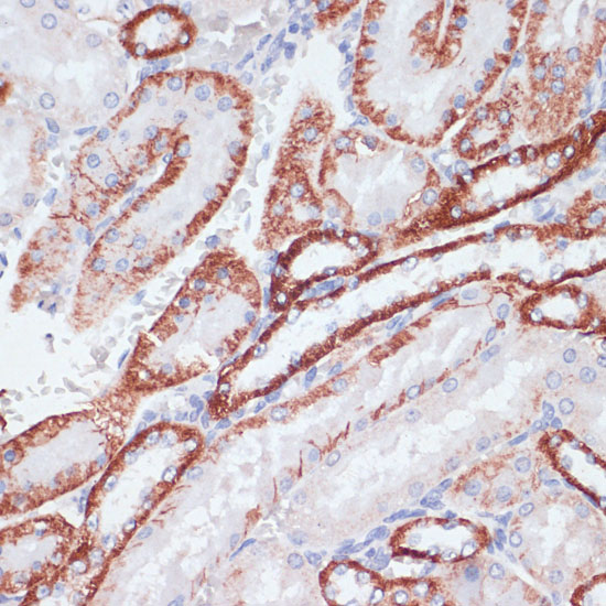 Immunohistochemistry of paraffin-embedded Rat kidney using TFRC Polyclonal Antibody at dilution of  1:100 (40x lens).