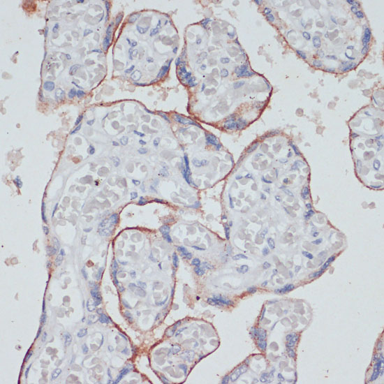 Immunohistochemistry of paraffin-embedded Human placenta using TFRC Polyclonal Antibody at dilution of  1:100 (40x lens).