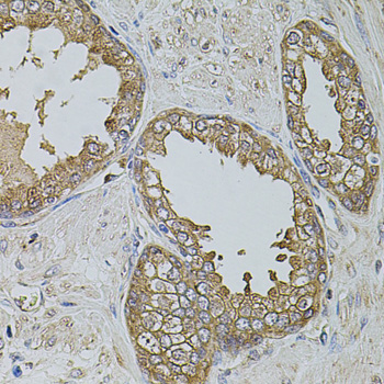 Immunohistochemistry of paraffin-embedded Human prostate using KTN1 Polyclonal Antibody at dilution of  1:100 (40x lens).