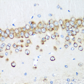 Immunohistochemistry of paraffin-embedded Rat brain using MTDH Polyclonal Antibody at dilution of  1:200 (40x lens).