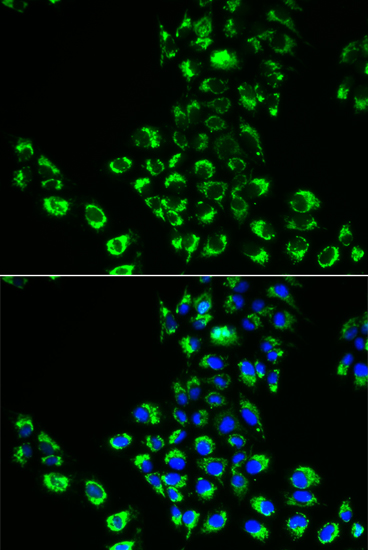 Immunofluorescence analysis of A549 cells using EIF5B Polyclonal Antibody