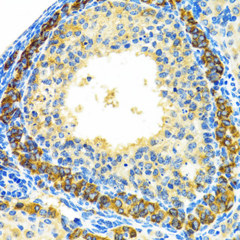 Immunohistochemistry of paraffin-embedded Rat ovary using MRPL28 Polyclonal Antibody at dilution of  1:100 (40x lens).