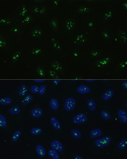 Immunofluorescence analysis of U-2 OS cells using NOLC1 Polyclonal Antibody at dilution of  1:100. Blue: DAPI for nuclear staining.