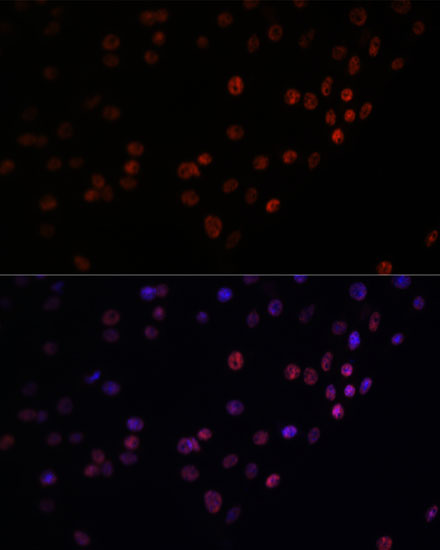 Immunofluorescence analysis of C6 cells using MATR3 Polyclonal Antibody at dilution of  1:100. Blue: DAPI for nuclear staining.