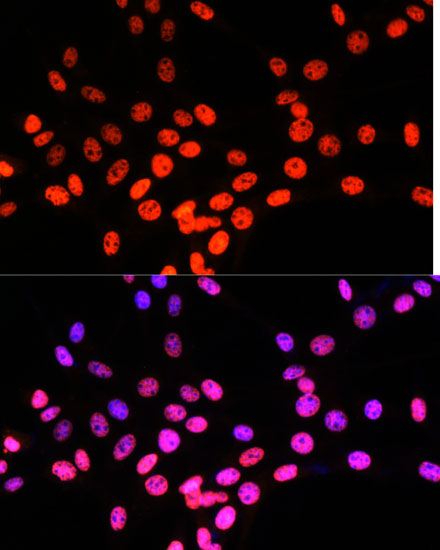 Immunofluorescence analysis of NIH/3T3 cells using MATR3 Polyclonal Antibody at dilution of  1:100. Blue: DAPI for nuclear staining.