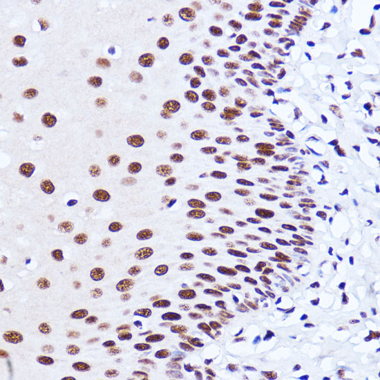 Immunohistochemistry of paraffin-embedded Human esophageal using MATR3 Polyclonal Antibody at dilution of  1:100 (40x lens).