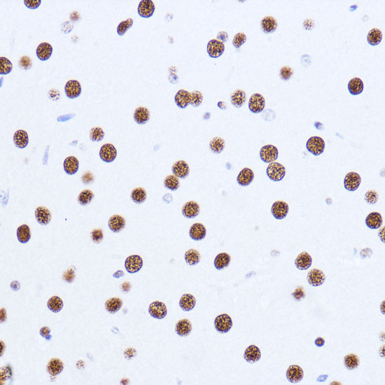 Immunohistochemistry of paraffin-embedded Mouse brain using MATR3 Polyclonal Antibody at dilution of  1:100 (40x lens).