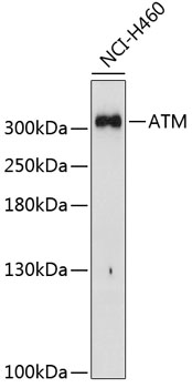 Western blot analysis of extracts of H460 cells using ATM Polyclonal Antibody at dilution of 1:1000.