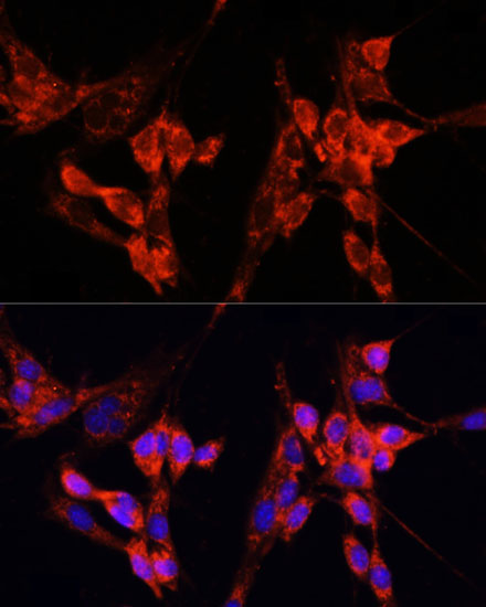 Immunofluorescence analysis of NIH-3T3 cells using ETF1 Polyclonal Antibody at dilution of  1:100 (40x lens). Blue: DAPI for nuclear staining.