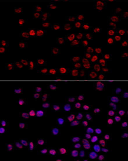 Immunofluorescence analysis of 293T cells using HNRNPH1 Polyclonal Antibody at dilution of  1:100 (40x lens). Blue: DAPI for nuclear staining.