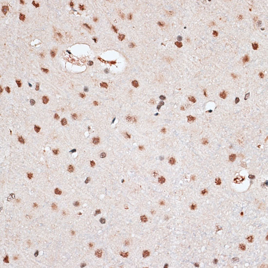 Immunohistochemistry of paraffin-embedded Rat brain using RBM3 Polyclonal Antibody at dilution of  1:100 (40x lens).