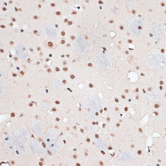 Immunohistochemistry of paraffin-embedded Mouse brain using RBM3 Polyclonal Antibody at dilution of  1:100 (40x lens).